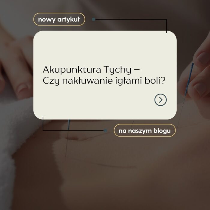 Akupunktura Tychy
